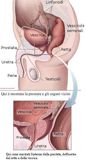 prostata ingrossata dimensioni