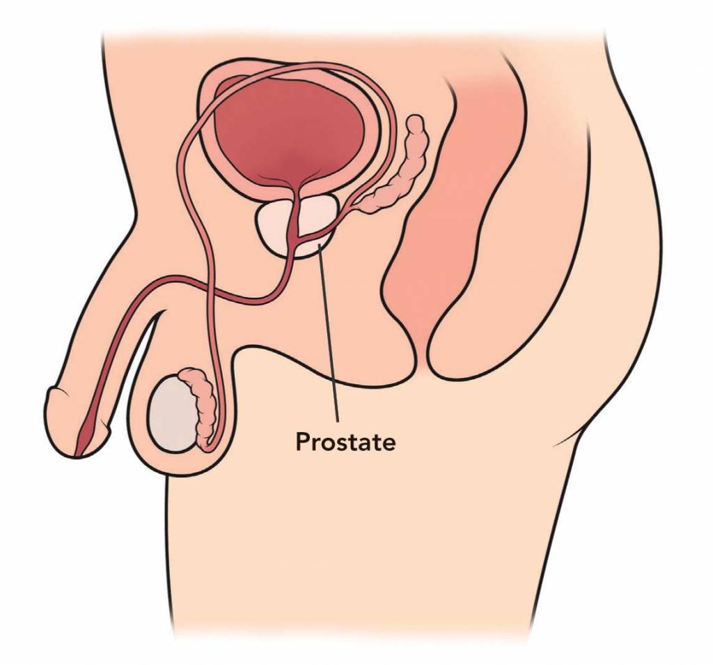 Prostata