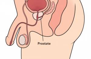 dottore ma il cetriolo fa male alla prostata