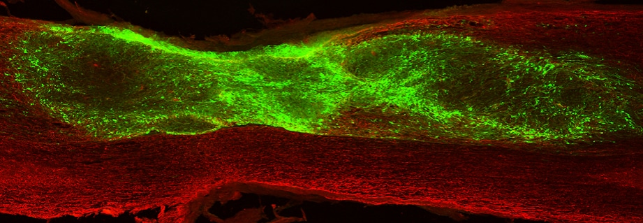 Individuata una nuova popolazione di cellule staminali che favorisce la riparazione delle lesioni al midollo spinale