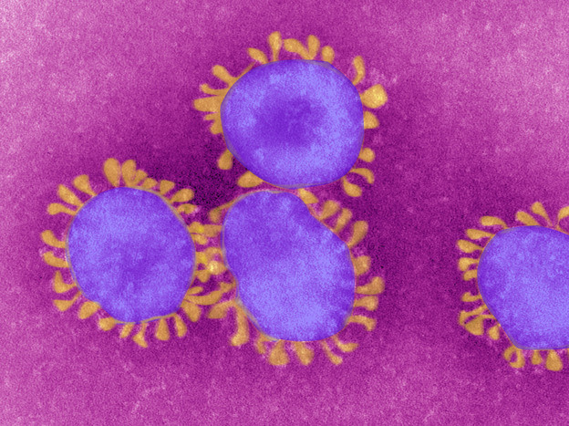 Coronavirus, 175 nuovi casi, 3.120 tamponi e 18 decessi in Toscana