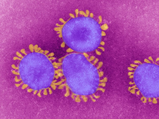 “Possiamo uscire dalla paura del coronavirus solo attraverso una nuova società, solidale”