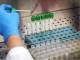 Coronavirus, test sierologici: definito accordo, 61 laboratori partecipano a screening su 400mila persone