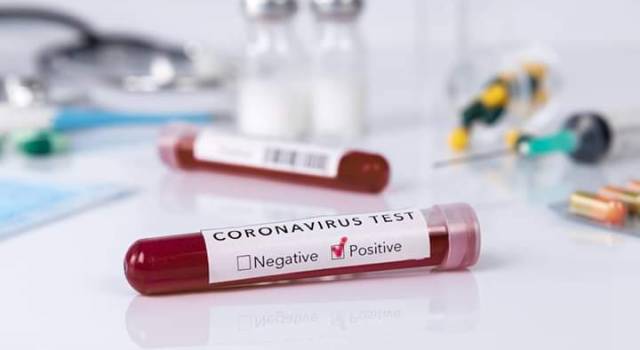 Coronavirus: 1 nuovo caso, 3 decessi, 91 guarigioni