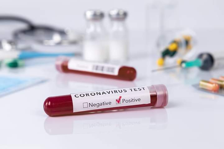 Coronavirus, 27 i nuovi casi (5 emersi dai test sierologici). 5 i decessi, 300 le guarigioni, di cui 229 virali