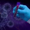 Coronavirus, 411 nuovi casi, 27 decessi